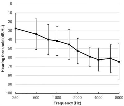 Effects of Hearing Aid Noise Reduction on Early and Late Cortical Representations of Competing Talkers in Noise